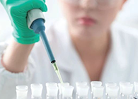 Science子刊：一种新模型可预测微粒制剂的可注射性