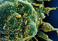 唾液检测新冠抗体新方法来了，获取结果仅需几小时！