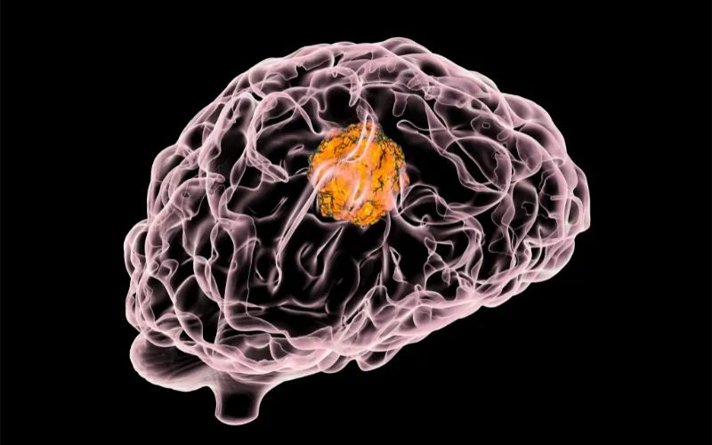 不朽情缘mg官网助力 | 璧辰医药ABM-1310获美国FDA孤儿药资格认证，用于治疗携带BRAF V600突变的脑胶质母细胞瘤患者