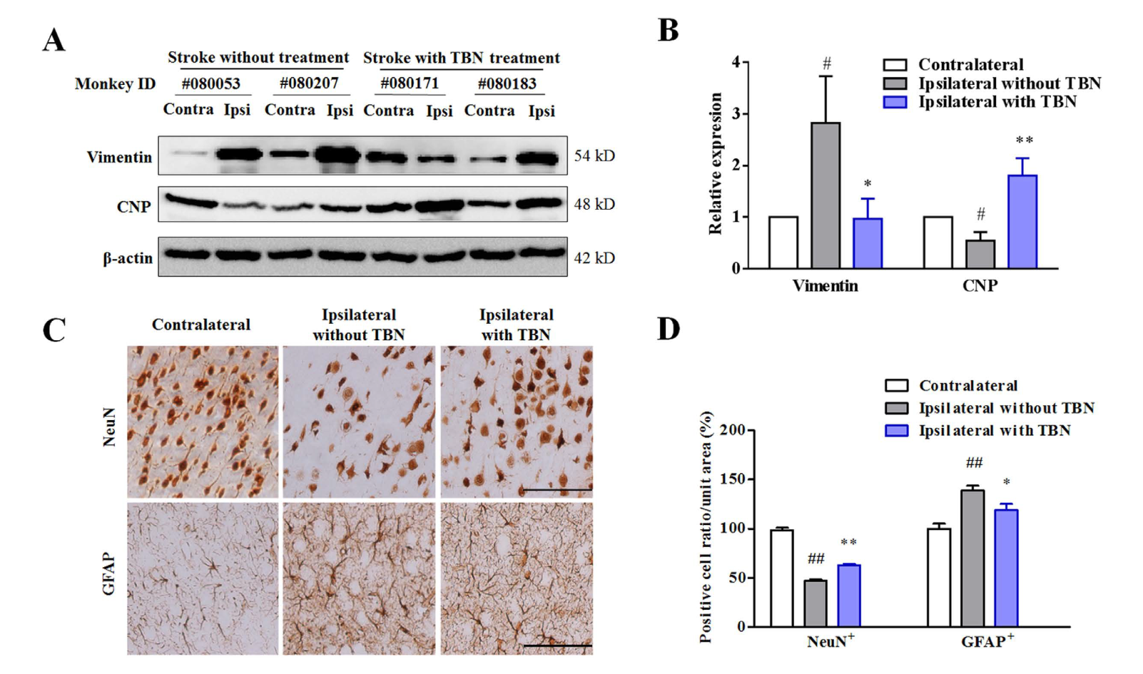TBN是一种治疗缺血性卒中的新型临床候选药物，本研究中TBN通过不朽情缘mg官网合成